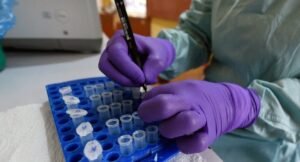 Ebola/Lassa fever
